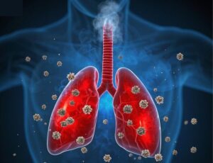 Common respiratory tract infections