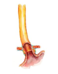 ESOPHAGUS