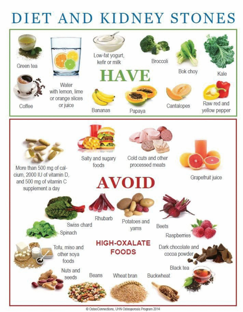 Kidney Stones: A Complete Guide from Anatomy to Treatment| HEH 3 image 3