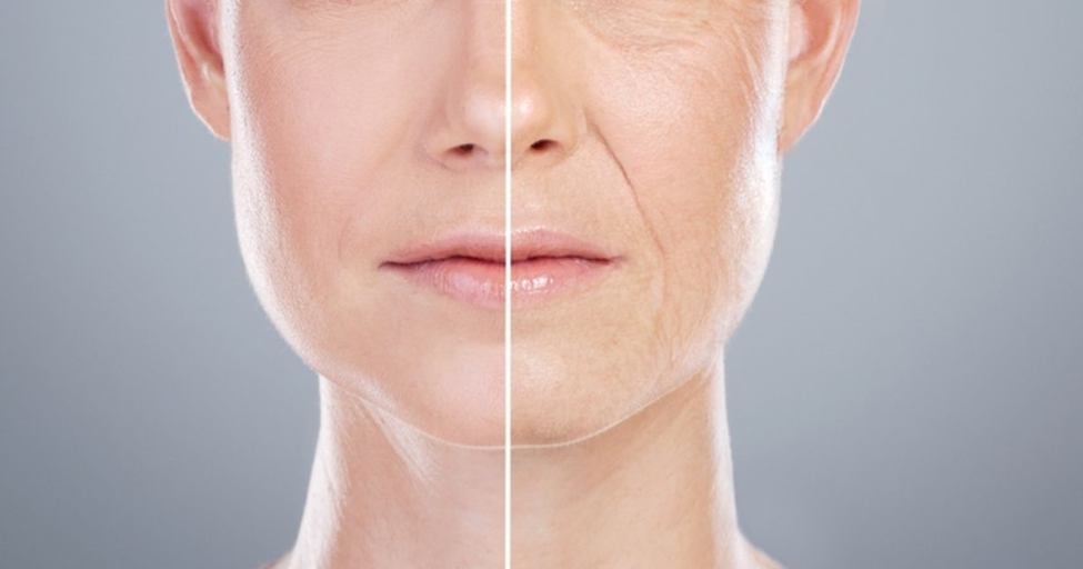 Glutathione and Skin Whitening, Facts, Science & Results| HEH 2 image 32
