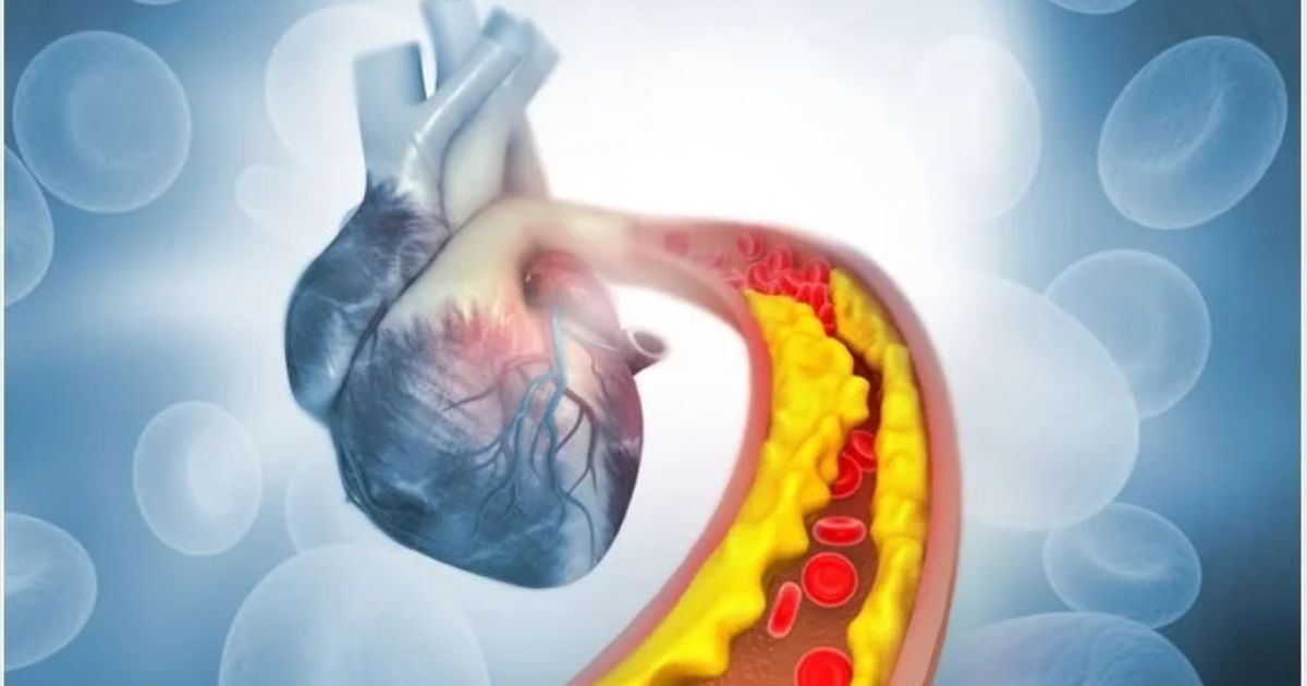 Untitled design (18) Heart health and cholesterol