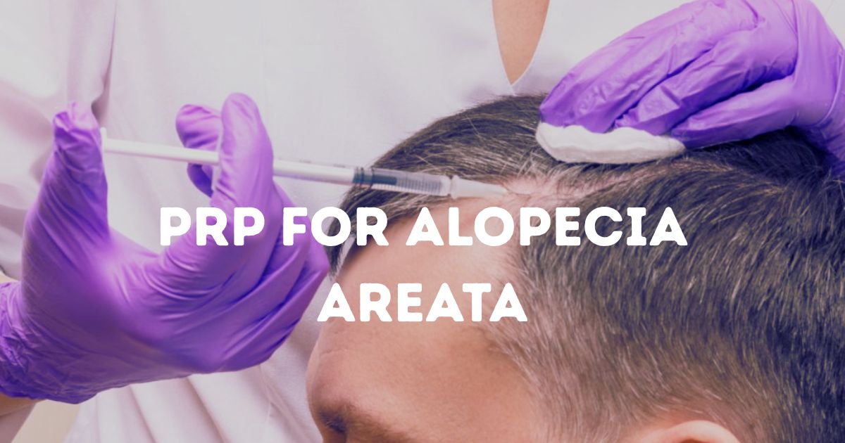 ALOPECIA AREATA (4) PRP FOR ALOPECIA AREATA