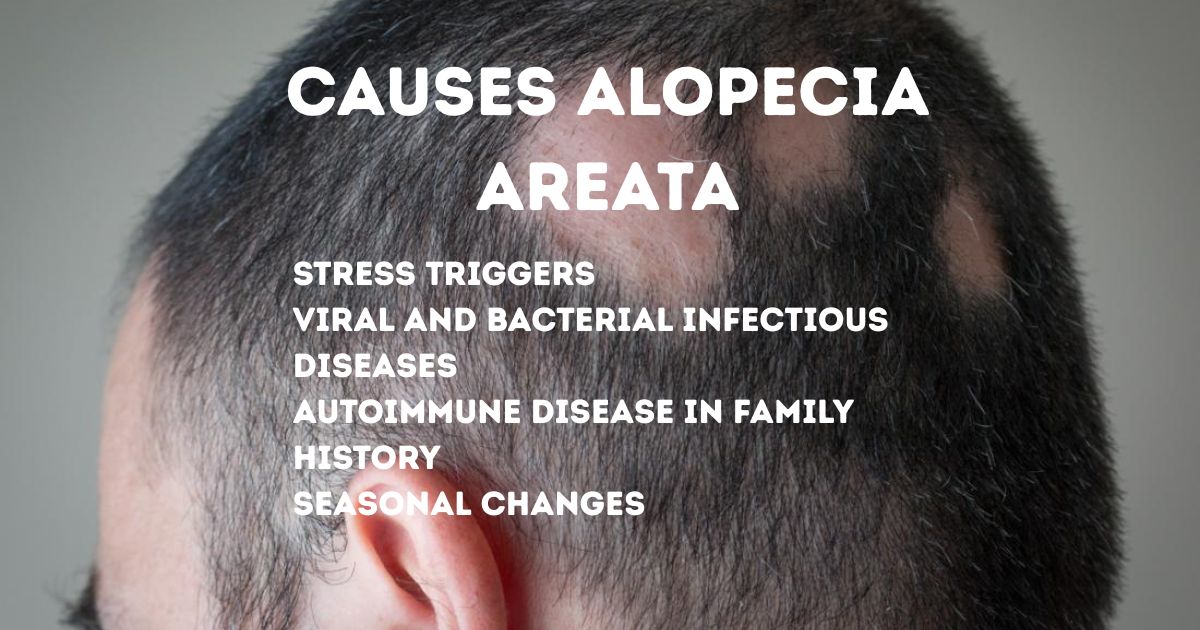 ALOPECIA AREATA (5) ALOPECIA AREATA TRIGGERS AND RISK FACTORS