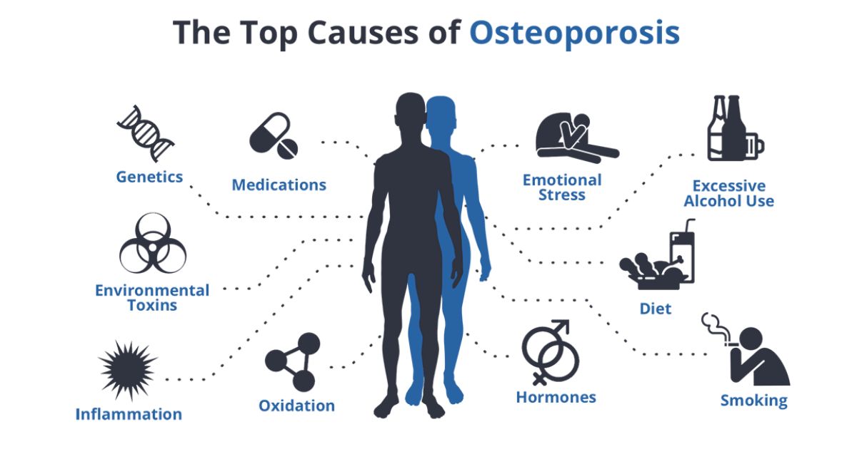 Osteoporosis and Osteoarthritis Causes Osteoporosis and Osteoarthritis Causes