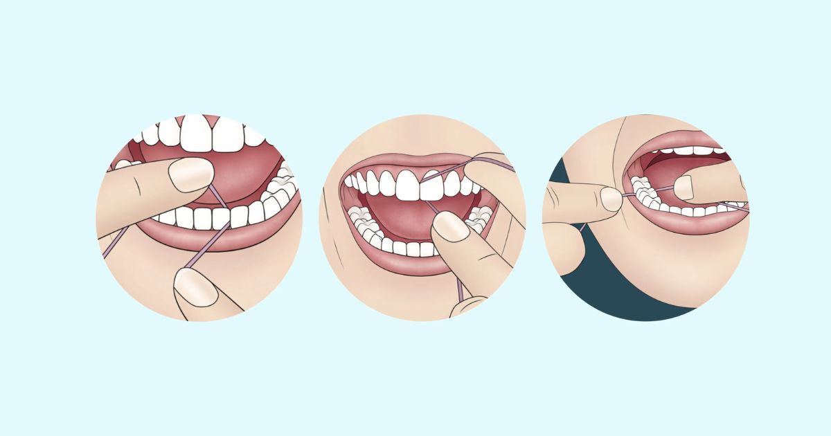 Prevention Tips to Protect Your Oral Health Prevention Tips to Protect Your Oral Health