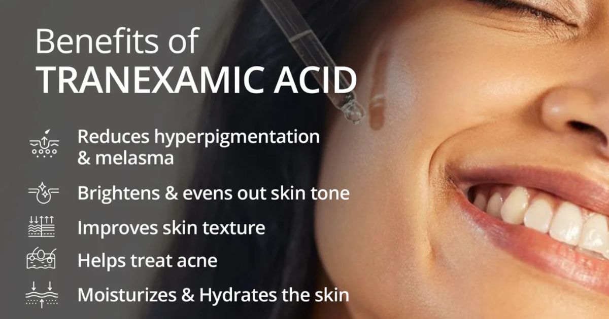 Benefits of Tranexamic Acid for Even Skin Tone Benefits of Tranexamic Acid for Even Skin Tone