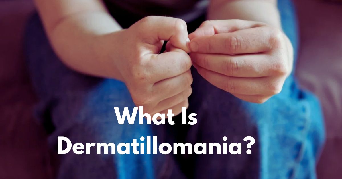 What Is Dermatillomania (Skin Picking Disorder)? What Is Dermatillomania (Skin Picking Disorder)?