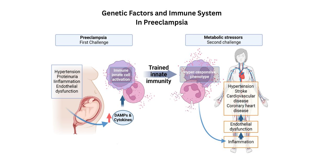 Genetic Factors and Immune System In Preeclampsia Genetic Factors and Immune System In Preeclampsia