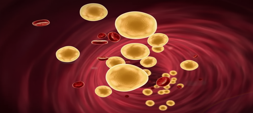 What is Dyslipidemia? Understanding the Silent Risk to Heart Health| HEH 1 image 3